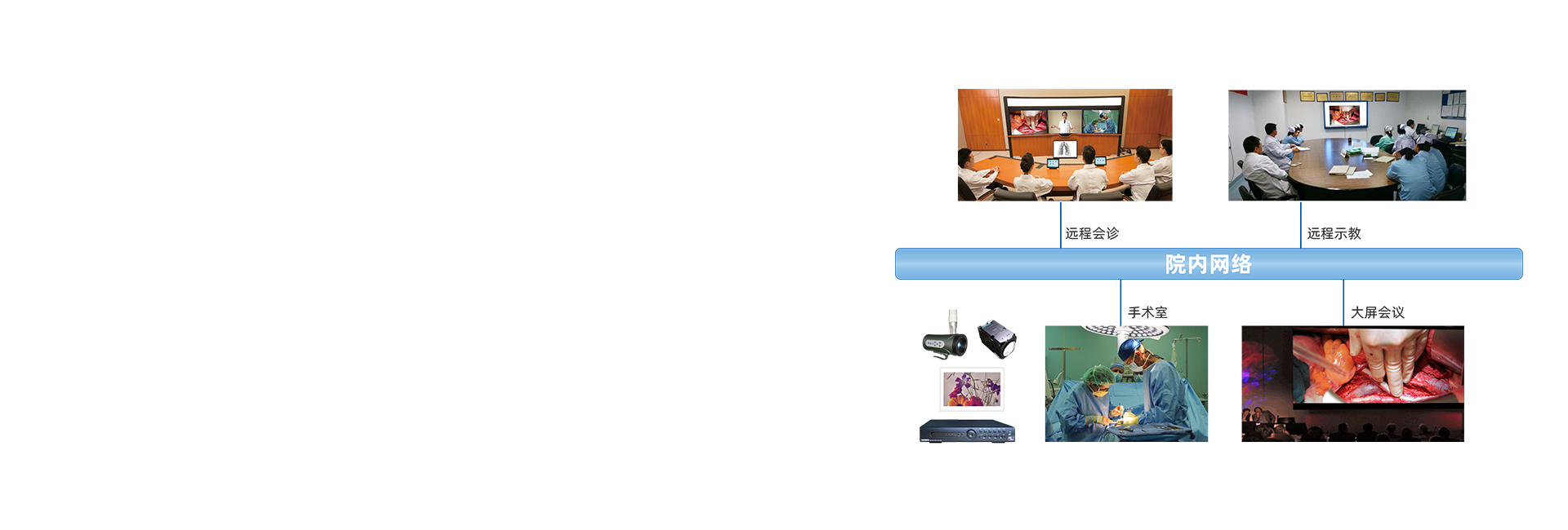 高清攝像系統(tǒng)【選配】